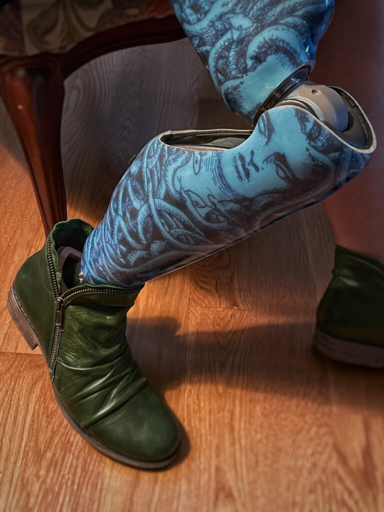 A close up of Jennifer’s prosthetic leg which features a bright blue Medusa design with black ink details. She is also wearing a dark green zipper boot.